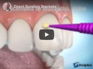 Collage des brackets