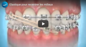 Élastiques transverses