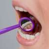 Contention orthodontie