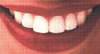 Sourire