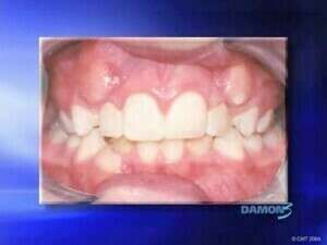 Présentation du système DAMON