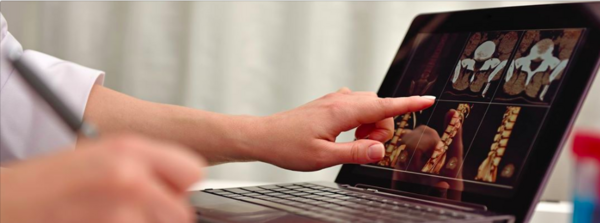 7 Millions de dollars pour la recherche chiropratique