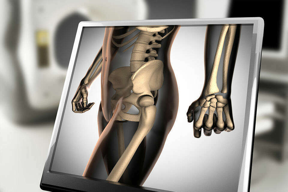 Prévenir et accompagner l’ostéoporose : les chiropracteurs en première ligne