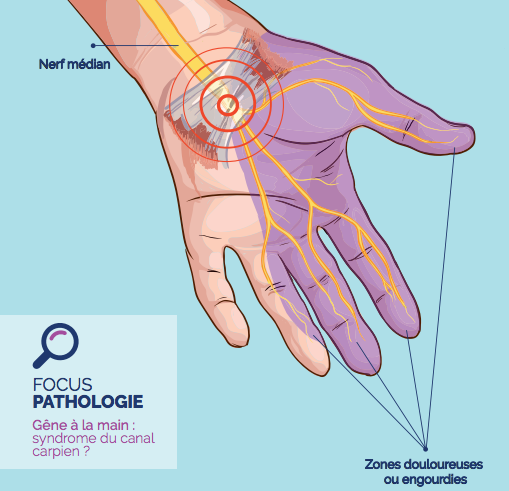 Newsletter - Septembre 2017