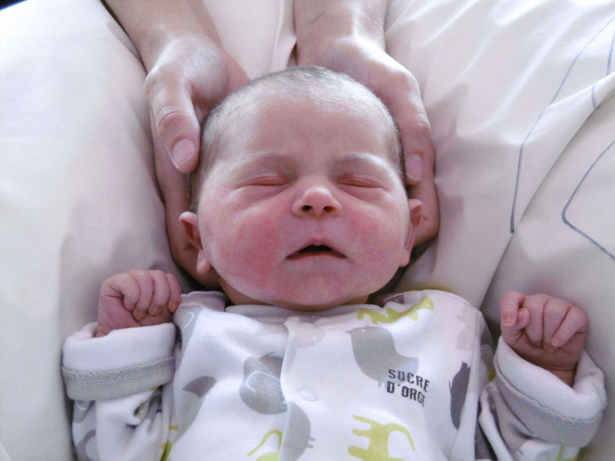 Aplatissement du crâne de bébé Blog