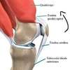Osgood schlatter pathologie croissance genou enfant sport par osteopathe Nandy