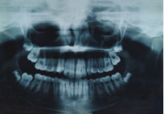 Radiologie dentaire