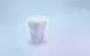 Dent