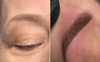 Diagnostic dermopigmentation personnalisé tarifs clairs Paris 18