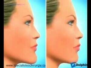 La chirurgie orthognathique