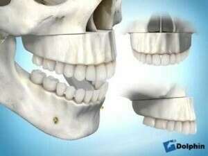 CHIRURGIE DES BEANCES