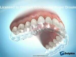 Importance appareil de rétention