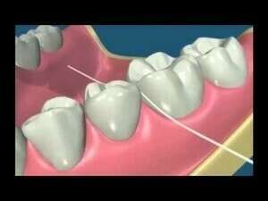 L'utilisation du fil dentaire