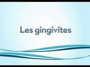 Résultat d'un mauvais brossage