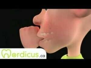 Sucer son pouce - Éducation dentaire