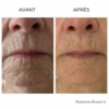 visage éclatant après soin jetpeel glow