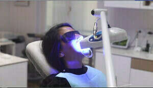 Blanchiment dentaire