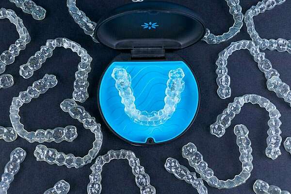 La technique invisalign® – align technology