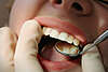 Orthodontie myofonctionnelle paris 17