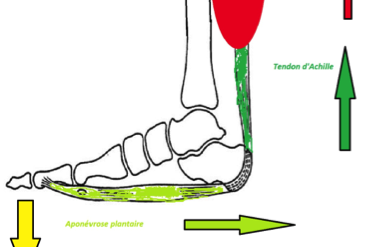 La brieveté des gastrocnémiens : conséquences mécaniques, cliniques et thérapeutiques