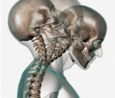 wiplash proosteo entreprise domicile evenement sportif osteopathe