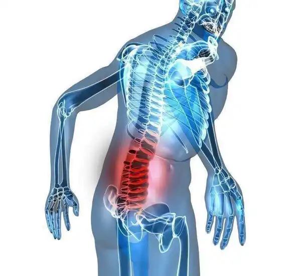 lombalgie douleur neuromusculaire ostéopathie proostéo