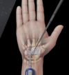 Hand pathologies | Surgery in Paris and Montigny