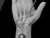echo chirurgie
