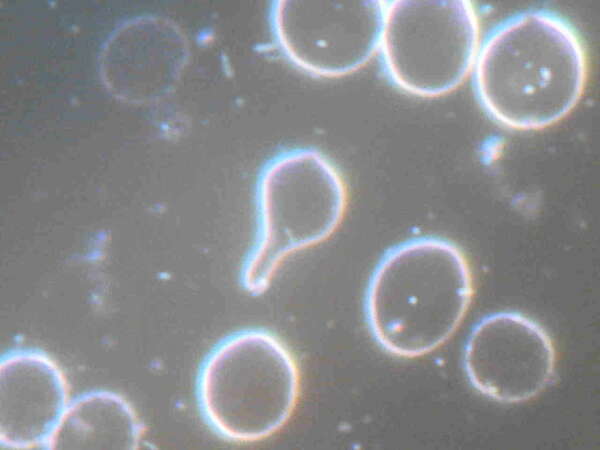 La microscopie au fond noir