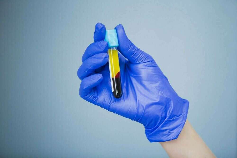 Qu'est-ce que le prf ?