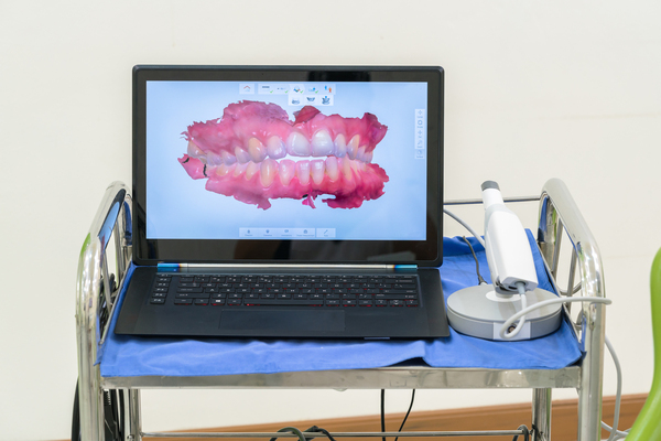 Découvrez les technologies avancées du cabinet dentaire : l'empreinte numérique