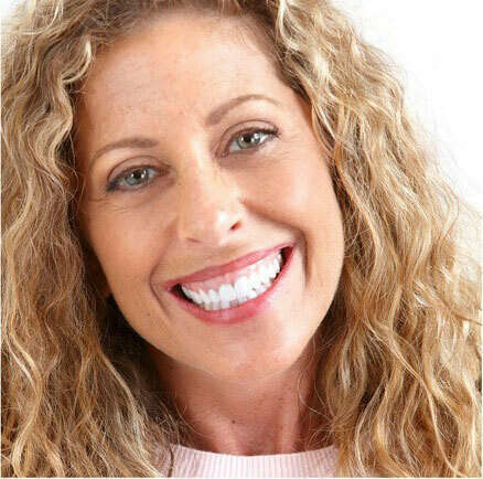 4 - Sourire gingival - Facette dentaire