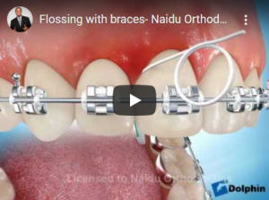 Nettoyage des brackets avec du fil dentaire