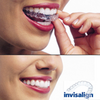 Invisalign® : traitement orthodontique discret et efficace pour un sourire aligné sans fil métallique 