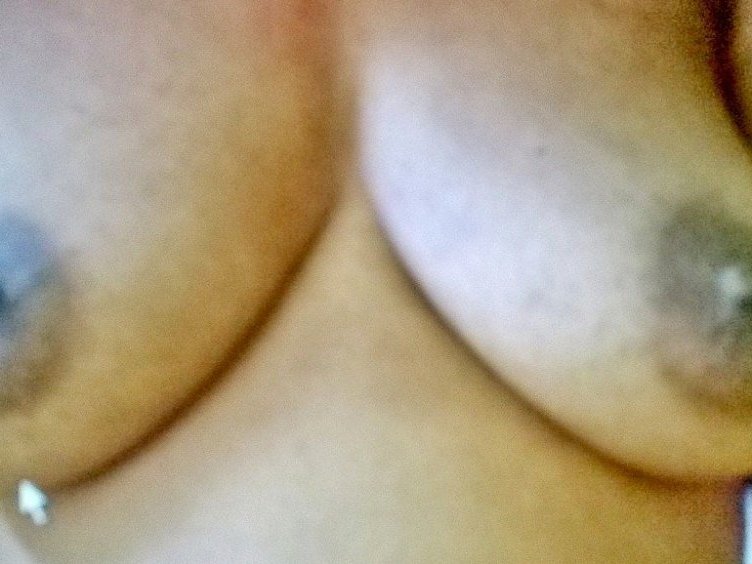 Ptose mammaire photo de départ