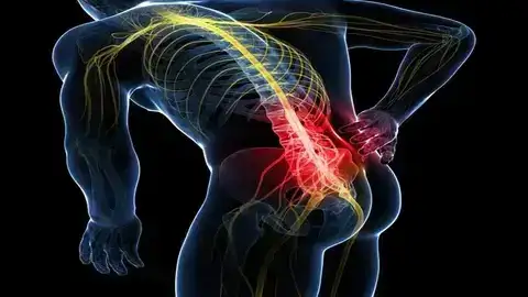 La sciatique : comprendre la douleur et retrouver l’équilibre grâce à une approche globale