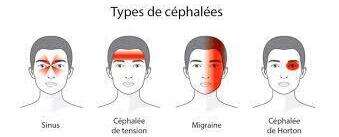 Migraines et céphalées : comprendre les maux de tête