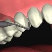 Etape 4 : La réévaluation à 3 mois