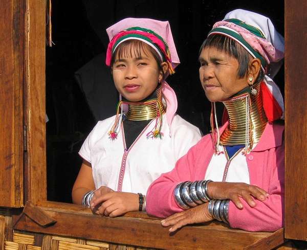 Ostéopathie & Torticolis