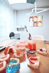 Modèles dentaires et appareils orthodontiques : bagues, gouttières et plaques