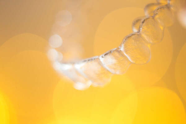 Les aligneurs invisibles : une solution pour les adultes exigeants - Dr Dauplais