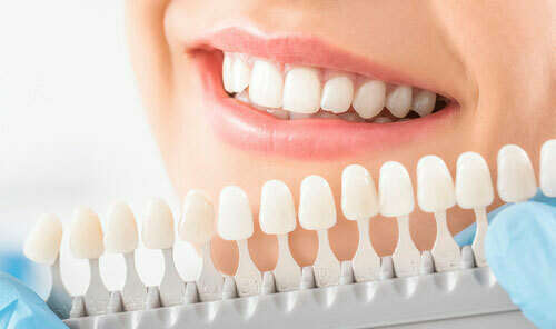 Les différents types de prothèses dentaires