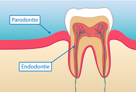 DENTISTE NANTERRE : ENDODONTIE ET PARODONTIE.