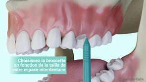 La brossette interdentaire