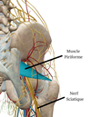 piriforme et sciatique