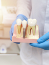 implants dentaires, Cabinet dentaire Drs GAGOSSIAN et FERRO Marseille