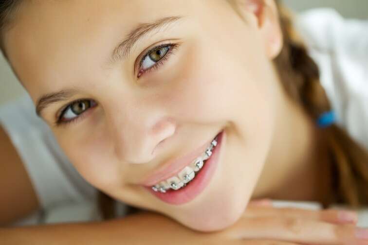 Quel appareil pour les adolescents ?
