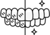 Esthétique dentaire : facettes céramiques et blanchiment