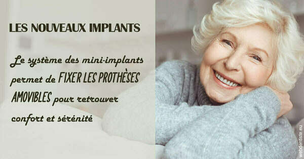 Les nouveaux implants