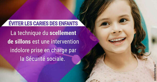 Le scellement de sillons